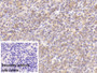 DAB staining on IHC-P; Sample: Porcine Spleen Tissue; Primary Ab: 20ug/ml Mouse Anti-Human MMP7 Antibody; Control: Used PBS instead of primary antibody; Second Ab: 2ug/ml HRP-Linked Caprine Anti-Mouse IgG Polyclonal Antibody