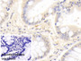 DAB staining on IHC-P; Sample: Porcine Colon Tissue Primary Ab: 20ug/ml Mouse Anti-Human MMP7 Antibody Control: Used PBS instead of primary antibody Second Ab: 2ug/ml HRP-Linked Caprine Anti-Mouse IgG Polyclonal Antibody