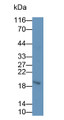 Western Blot; Sample: Human Lung lysate Primary Ab: 2ug/ml Mouse Anti-Human CTLA4 Antibody Second Ab: 0.2ug/ml HRP-Linked Caprine Anti-Mouse IgG Polyclonal Antibody