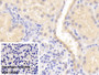 DAB staining on IHC-P; Sample: Porcine Kidney Tissue; Primary Ab: 20ug/ml Mouse Anti-Human a2PI Antibody; Control: Used PBS instead of primary antibody; Second Ab: 2ug/ml HRP-Linked Caprine Anti-Mouse IgG Polyclonal Antibody