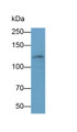 Western Blot; Sample: 3T3-L1 cell lysate Primary Ab: 0.6ug/ml Mouse Anti-Human ITGaV Antibody Second Ab: 0.2ug/ml HRP-Linked Caprine Anti-Mouse IgG Polyclonal Antibody