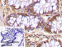 DAB staining on IHC-P; Sample: Porcine Colon Tissue Primary Ab: 40ug/ml Mouse Anti-Multi-species Ub Antibody Control: Used PBS instead of primary antibody Second Ab: 2ug/ml HRP-Linked Caprine Anti-Mouse IgG Polyclonal Antibody