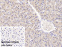 DAB staining on IHC-P; Sample: Porcine Liver Tissue Primary Ab: 20ug/ml Mouse Anti-Human ALT Antibody Control: Used PBS instead of primary antibody Second Ab: 2ug/ml HRP-Linked Caprine Anti-Mouse IgG Polyclonal Antibody