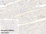 DAB staining on IHC-P; Sample: Porcine Cardiac Muscle Tissue Primary Ab: 10ug/ml Mouse Anti-Human VEGF165 Antibody Control: Used PBS instead of primary antibody Second Ab: 2ug/ml HRP-Linked Caprine Anti-Mouse IgG Polyclonal Antibody