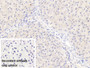 DAB staining on IHC-P; Sample: Porcine Liver Tissue; Primary Ab: 30ug/ml Mouse Anti-Human VEGF165 Antibody; Control: Used PBS instead of primary antibody; Second Ab: 2ug/ml HRP-Linked Caprine Anti-Mouse IgG Polyclonal Antibody
