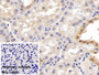 DAB staining on IHC-P; Sample: Porcine Kidney Tissue; Primary Ab: 30ug/ml Mouse Anti-Human APOH Antibody; Control: Used PBS instead of primary antibody; Second Ab: 2ug/ml HRP-Linked Caprine Anti-Mouse IgG Polyclonal Antibody
