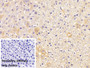 DAB staining on IHC-P; Sample: Rat Liver Tissue; Primary Ab: 30ug/ml Mouse Anti-Human APOH Antibody; Control: Used PBS instead of primary antibody; Second Ab: 2ug/ml HRP-Linked Caprine Anti-Mouse IgG Polyclonal Antibody