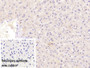 DAB staining on IHC-P; Sample: Porcine Liver Tissue Primary Ab: 40ug/ml Mouse Anti-Human SHBG Antibody Control: Used PBS instead of primary antibody Second Ab: 2ug/ml HRP-Linked Caprine Anti-Mouse IgG Polyclonal Antibody