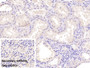 DAB staining on IHC-P; Sample: Porcine Kidney Tissue; Primary Ab: 40ug/ml Mouse Anti-Human SHBG Antibody; Control: Used PBS instead of primary antibody; Second Ab: 2ug/ml HRP-Linked Caprine Anti-Mouse IgG Polyclonal Antibody