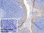 DAB staining on IHC-P; Sample: Human Tonsil Tissue Primary Ab: 10ug/ml Mouse Anti-Human CK17 Antibody Control: Used PBS instead of primary antibody Second Ab: 2ug/ml HRP-Linked Caprine Anti-Mouse IgG Polyclonal Antibody