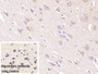 DAB staining on IHC-P; Sample: Porcine Cerebrum Tissue Primary Ab: 40ug/ml Mouse Anti-Human NRGN Antibody Control: Used PBS instead of primary antibody Second Ab: 2ug/ml HRP-Linked Caprine Anti-Mouse IgG Polyclonal Antibody