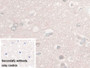 DAB staining on IHC-P; Sample: Human Cerebrum Tissue Primary Ab: 30ug/ml Mouse Anti-Human NSE Antibody Control: Used PBS instead of primary antibody Second Ab: 2ug/ml HRP-Linked Caprine Anti-Mouse IgG Polyclonal Antibody
