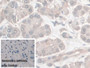 DAB staining on IHC-P; Sample: Human Pancreatic cancer Tissue; Primary Ab: 30ug/ml Mouse Anti-Human NSE Antibody; Control: Used PBS instead of primary antibody; Second Ab: 2ug/ml HRP-Linked Caprine Anti-Mouse IgG Polyclonal Antibody