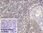 DAB staining on IHC-P; Sample: Porcine Spleen Tissue; Primary Ab: 30ug/ml Mouse Anti-Human VF Antibody; Control: Used PBS instead of primary antibody; Second Ab: 2ug/ml HRP-Linked Caprine Anti-Mouse IgG Polyclonal Antibody