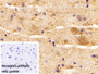 DAB staining on IHC-P; Sample: Mouse Spinal cord Tissue; Primary Ab: 30ug/ml Mouse Anti-Human AST2 Antibody; Control: Used PBS instead of primary antibody; Second Ab: 2ug/ml HRP-Linked Caprine Anti-Mouse IgG Polyclonal Antibody