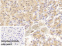 DAB staining on IHC-P; Sample: Porcine Liver Tissue; Primary Ab: 40ug/ml Mouse Anti-Human HIF1a Antibody; Control: Used PBS instead of primary antibody; Second Ab: 2ug/ml HRP-Linked Caprine Anti-Mouse IgG Polyclonal Antibody