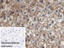 DAB staining on IHC-P; Sample: Human Liver Tissue Primary Ab: 20ug/ml Mouse Anti-Human Hpt Antibody Control: Used PBS instead of primary antibody Second Ab: 2ug/ml HRP-Linked Caprine Anti-Mouse IgG Polyclonal Antibody