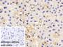 DAB staining on IHC-P; Sample: Mouse Liver Tissue; Primary Ab: 30ug/ml Mouse Anti-Rat F2 Antibody; Control: Used PBS instead of primary antibody; Second Ab: 2ug/ml HRP-Linked Caprine Anti-Mouse IgG Polyclonal Antibody