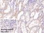 DAB staining on IHC-P; Sample: Porcine Kidney Tissue; Primary Ab: 40ug/ml Mouse Anti-Human ASPH Antibody; Control: Used PBS instead of primary antibody; Second Ab: 2ug/ml HRP-Linked Caprine Anti-Mouse IgG Polyclonal Antibody
