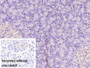 DAB staining on IHC-P; Sample: Porcine Pancreas Tissue; Primary Ab: 40ug/ml Mouse Anti-Human ASPH Antibody; Control: Used PBS instead of primary antibody; Second Ab: 2ug/ml HRP-Linked Caprine Anti-Mouse IgG Polyclonal Antibody