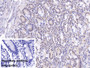 DAB staining on IHC-P; Sample: Porcine Small intestine Tissue Primary Ab: 20ug/ml Mouse Anti-Human DNAH11 Antibody Control: Used PBS instead of primary antibody Second Ab: 2ug/ml HRP-Linked Caprine Anti-Mouse IgG Polyclonal Antibody