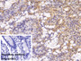 DAB staining on IHC-P; Sample: Porcine Small intestine Tissue Primary Ab: 20ug/ml Mouse Anti-Human DNAH11 Antibody Control: Used PBS instead of primary antibody Second Ab: 2ug/ml HRP-Linked Caprine Anti-Mouse IgG Polyclonal Antibody