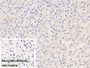 DAB staining on IHC-P; Sample: Porcine Liver Tissue Primary Ab: 30ug/ml Mouse Anti-Human LCAT Antibody Control: Used PBS instead of primary antibody Second Ab: 2ug/ml HRP-Linked Caprine Anti-Mouse IgG Polyclonal Antibody