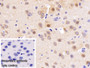DAB staining on IHC-P; Sample: Rat Cerebrum Tissue; Primary Ab: 30ug/ml Mouse Anti-Human NSE Antibody; Control: Used PBS instead of primary antibody; Second Ab: 2ug/ml HRP-Linked Caprine Anti-Mouse IgG Polyclonal Antibody