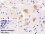 DAB staining on IHC-P; Sample: Rat Cerebellum Tissue; Primary Ab: 30ug/ml Mouse Anti-Human NSE Antibody; Control: Used PBS instead of primary antibody; Second Ab: 2ug/ml HRP-Linked Caprine Anti-Mouse IgG Polyclonal Antibody