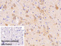 DAB staining on IHC-P; Sample: Rat Spinal cord Tissue; Primary Ab: 30ug/ml Mouse Anti-Human NSE Antibody; Control: Used PBS instead of primary antibody; Second Ab: 2ug/ml HRP-Linked Caprine Anti-Mouse IgG Polyclonal Antibody