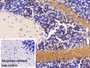 DAB staining on IHC-P; Sample: Mouse Cerebellum Tissue; Primary Ab: 10ug/ml Rabbit Anti-Human KCNN2 Antibody; Control: Used PBS instead of primary antibody; Second Ab: 2ug/ml HRP-Linked Caprine Anti-Rabbit IgG Polyclonal Antibody