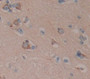 IHC Images