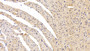 DAB staining on IHC-P; Sample: Rat Cardiac Muscle Tissue; Primary Ab: 30ug/ml Mouse Anti-Rat BNP Antibody Second Ab: 2ug/mL HRP-Linked Caprine Anti-Mouse IgG Polyclonal Antibody