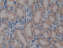 DAB staining on IHC-P; Samples: Mouse Kidney Tissue; Primary Ab: 10ug/ml Rabbit Anti-Human PTX3 Antibody Second Ab: 2ug/mL HRP-Linked Caprine Anti-Rabbit IgG Polyclonal Antibody