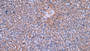 DAB staining on IHC-P; Sample: Human Liver Tissue; Primary Ab: 10ug/ml Mouse Anti-Human Hpt Antibody Second Ab: 2ug/mL HRP-Linked Caprine Anti-Mouse IgG Polyclonal Antibody
