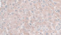 DAB staining on IHC-P; Sample: Human Liver Tissue; Primary Ab: 30ug/ml Mouse Anti-Human Hpt Antibody Second Ab: 2ug/mL HRP-Linked Caprine Anti-Mouse IgG Polyclonal Antibody