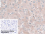 DAB staining on IHC-P; Sample: Human Liver Tissue; Primary Ab: 30ug/ml Mouse Anti-Human Hpt Antibody; Control: Used PBS instead of primary antibody; Second Ab: 2ug/ml HRP-Linked Caprine Anti-Mouse IgG Polyclonal Antibody