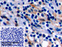 DAB staining on IHC-P; Sample: Human Tonsil Tissue; Primary Ab: 10ug/ml Mouse Anti-Human ACTB Antibody; Control: Used PBS instead of primary antibody; Second Ab: 2ug/ml HRP-Linked Caprine Anti-Mouse IgG Polyclonal Antibody