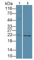 Western Blot; Sample: Lane1: Mouse Liver lysate; Lane1: Mouse Cerebellum lysate Primary Ab: 2ug/ml Rabbit Anti-Multi-species PTHrP Antibody Second Ab: 0.2ug/mL HRP-Linked Caprine Anti-Rabbit IgG Polyclonal Antibody