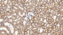 DAB staining on IHC-P; Sample: Rat Kidney Tissue; Primary Ab: 20ug/ml Mouse Anti-Multi-species STAT3 Antibody; Second Ab: 2ug/mL HRP-Linked Caprine Anti-Mouse IgG Polyclonal Antibody