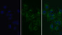 FITC staining on IF; Sample: Human Hela cell; Primary Ab: 30ug/ml Mouse Anti-Human TFR Antibody Second Ab: 5ug/ml FITC-Linked Caprine Anti-Mouse IgG Polyclonal Antibody