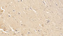 DAB staining on IHC-P; Sample: Human Cerebrum Tissue; Primary Ab: 30ug/ml Mouse Anti-Human DMD Antibody Second Ab: 2ug/mL HRP-Linked Caprine Anti-Mouse IgG Polyclonal Antibody