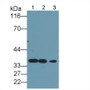 Western Blot; Sample: Lane1: Rat Testis lysate; Lane2: Hela cell lysate; Lane3: MCF7 cell lysate Primary Ab: 0.2ug/ml Mouse Anti-Human PCNA Antibody Second Ab: 0.2ug/mL HRP-Linked Caprine Anti-Mouse IgG Polyclonal Antibody