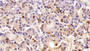 DAB staining on IHC-P; Sample: Porcine Pituitary Tissue; Primary Ab: 20ug/ml Mouse Anti-Human PRL Antibody Second Ab: 2ug/mL HRP-Linked Caprine Anti-Mouse IgG Polyclonal Antibody