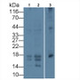 Western Blot; Sample: Lane1: Hela cell lysate; Lane2: HepG2 cell lysate; Lane3: Rat Uterus lysate Primary Ab: 3ug/ml Mouse Anti-Multi-species PIIINP Antibody Second Ab: 0.2ug/mL HRP-Linked Caprine Anti-Mouse IgG Polyclonal Antibody