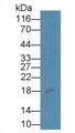Western Blot; Sample: Rat Uterus lysate Primary Ab: 6ug/ml Mouse Anti-Multi-species PIIINP Antibody Second Ab: 0.2ug/mL HRP-Linked Caprine Anti-Mouse IgG Polyclonal Antibody
