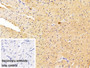 DAB staining on IHC-P; Sample: Rat Cardiac Muscle Tissue; Primary Ab: 10ug/ml Rabbit Anti-Human RYR2 Antibody; Control: Used PBS instead of primary antibody; Second Ab: 2ug/ml HRP-Linked Caprine Anti-Rabbit IgG Polyclonal Antibody