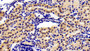 DAB staining on IHC-P; Sample: Human Kidney Tissue; Primary Ab: 10ug/ml Rabbit Anti-Human ATP2A2 Antibody Second Ab: 2ug/mL HRP-Linked Caprine Anti-Rabbit IgG Polyclonal Antibody