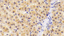 DAB staining on IHC-P; Sample: Human Liver Tissue; Primary Ab: 10ug/ml Rabbit Anti-Human ATP2A2 Antibody; Second Ab: 2ug/mL HRP-Linked Caprine Anti-Rabbit IgG Polyclonal Antibody
