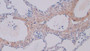 DAB staining on IHC-P; Sample: Human Lung Tissue; Primary Ab: 10ug/ml Rabbit Anti-Human CTXI Antibody Second Ab: 2ug/mL HRP-Linked Caprine Anti-Rabbit IgG Polyclonal Antibody